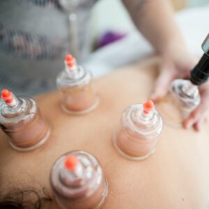 Rakta Mokshana (Cupping Treatment) 90 Minutes